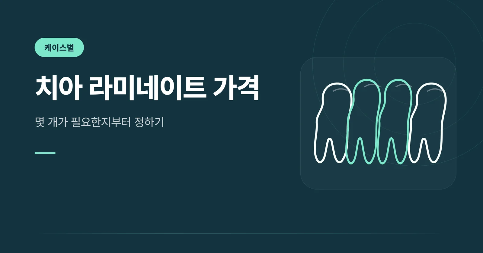 치아 라미네이트 가격